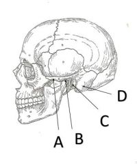 Name surface feature A on zygomatic cranial bone?