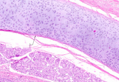 What is the pink-staining supporting tissue along the periphery of the hyaline cartilage (dark purple)?