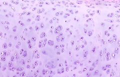 What is the name of the compartments / cavities that are occupied by chondrocytes?