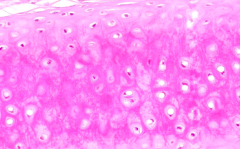 Heterogenous - pink, stringy appearance of ECM d/t presence of elastic fibers that do not stain well