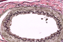 Elastic fibers (black) in connective tissue and walls of blood vessels