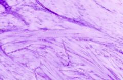 - Fibrocartilage 
- Chondrocytes are surrounded by very little matrix and tend to be arranged in rows between coarse bundles of collagen fibers
- Alternating arrangement of collagen bundles in adjacent layers of fibrocartilage
- No perichondrium