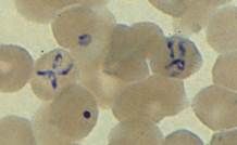 tetrad formation- parasites in RBCs.