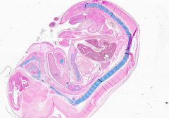 This is an image of a mouse embryo, how does the cartilage compare to mature cartilage?