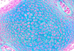 Developing cartilage has MORE cells and LESS matrix