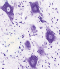 Neuron - Nissl stain