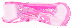 The collagen fiber bundles (pink) are oriented in what manner?
