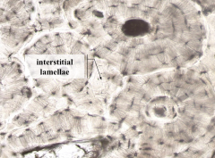 Interstitial Lamellae (remnants of older osteons that have been partially resorbed)