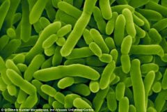 A high number of bacteria as the more bacteria presence the more light absorbed