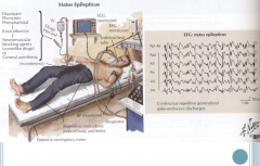 Recurrent episodes of tonic-clonic seizures
-Remain unconscious and without normal muscle movement between episodes
-Lack of oxygen can lead to brain damage
Requires immediate cardiovascular, respiratory, and metabolic management
