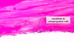 Why are these purple osteoblasts and osteoprogenitor cells considered "basophilic"?