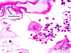 Chondroclasts (multinucleated cells) - histologically indistinguishable from osteoclasts