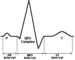 QRS interval