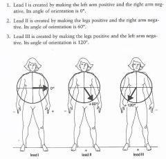I: arm leads only = 0


II: legs + & R arm - = +60


III: legs + & L arm - = +120


 


(arm lead travels from shoulder)