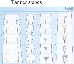 There are 6 tanner stages, and they correspond to level of development in males and females. 