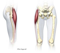 Tensor fasciae latae

Origin: iliac crest and anterior superior iliac spine

Insertion: iliotibial tract


action: Flexion, abduction and medial rotation at hip