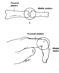 Diarthrodial joints
Permits motion around a single axis.

Ex. Similar to door hinge, IP joints of fingers