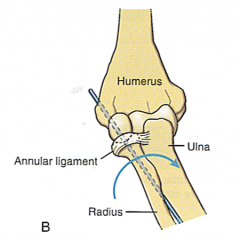1st Component: Shaped like a ring

2nd Component: Shaped so that it can rotate within the ring

Ex. AA joint, radiohumeral joint