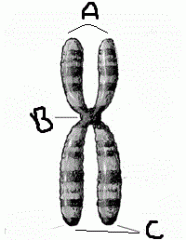 In the diagram of a chromosome, identify the indicated structures.
