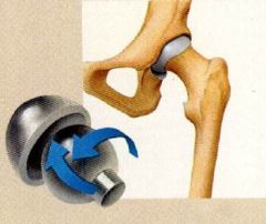 Formed by a ball-like convex surface being fitted into a concave socket

Ex. Hip & shoulder joints.