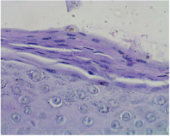 Retained nuclei in stratum corneum