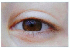 At det vil komme til udtryk og undertrykke recissive gener.  Genet for brune øjne er dominerende overfor blå.