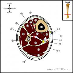  ___ artery is a branch of the popliteal artery and carries blood to the posterior compartment of the leg and plantar surface of the foot. 