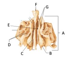 What is the name the cranial bone (A)? 
