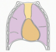 The mediastinum and 2 pulmonary cavities