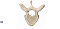 -Heart Shaped body
-Round vertebral foramen
-Long, downward point spinous process