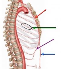 Internal thoracic artery (red)
Anastomosis (green)
Musculophrenic artery (purple)
Superior Epigastric artery (blue)