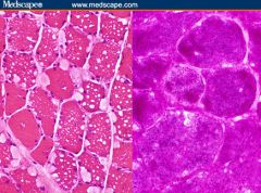 describe;
which stain is helpful in identifying the material in the cells?