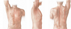 A line through the sternum in the midline