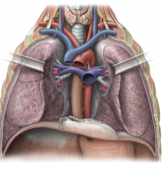 The hilum is the space on the medial lung which allows for its attachments where the root is the vessels themselves including pulmonary arteries and veins, bronchi, bronchial vessels, etc