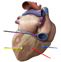 Left Ventricle (yellow)
Right Ventricle (blue)
Posterior Interventricular Sulcus (red)
Crux of the heart (purple)