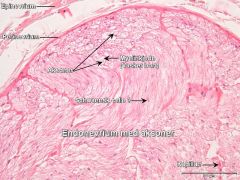 Kalles ENDOnevriet
Fasikkel innholder:
Aksoner (alle typer nerverøtter)
Swannske celler, kappillærer med endotel, noe bindevev m. fibroblaster