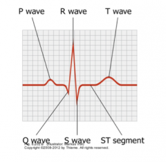 Through an electrocardiogram (EKG/ECG)
