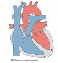 AV valves close
AV node initiates ventricular contraction