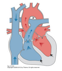 Semilunar valves open
Ventricles Contract