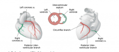 The posterior interventricular artery arises from the circumflex artery (a branch of the left coronary artery) and supplies the AV node of the heart. The entire interventricular septum is supplied by the left coronary artery in these people.