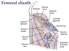 Bowel/fat can form femoral hernia via femoral ring