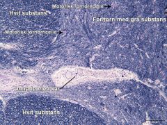 - Motoriske forhornsceller

Perikaryon - den delen av cytoplasma i en nervecelle som er i nærheten av kjernen. (peri = omkring, karyon = kjerne)