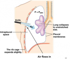 Air in pleural cavity breaks the fluid bond holding the lung to the chest wall

Chest wall expands outward