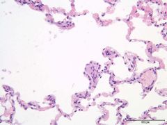 Hvilke typer celler finner man i epitelet til alveolene?