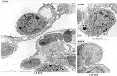 Alveolære makrofager