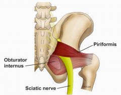 the piriformis can cause issues with sciatic nerve


 


88% of people have sciatica