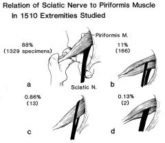 A. sciatic nerve runs under piriformis


 


B. piriformis bisects sciatic nerve


 


C. piriformis runs in middle of sciatic nerve


 


D. sciatic nerve runs in midde of piriformis