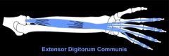 Extensor Digitorum Communis:
Nerve: Posterior Interosseous
Roots: C7-C8
Trunk: Middle & Lower Trunk
Cord: Posterior
Action: Finger extension (digits 2-5)
Test: Have the patient extend digits 2-5. For the purposes of manual muscle testing, it may b...