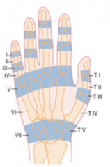 Key zones: 


I - Mallet finger


III - Boutonniere deformity


V - Fight bite