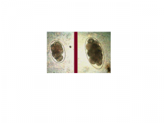 Række: Nemathelminthes 
Klasse: nematoda 
Orden: strongylida 
Familie: trichostrongyloidae (løbe- og tarmstrongylider)

Løbetarmorm hos kvæg

– tyndtarm 
– adulte 5-10 mm
- har mellemlang forlængelse af hudskede
- typiske strongylid...